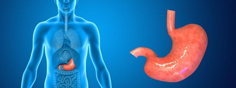 Kann man von einer Magenverkleinerung sterben?